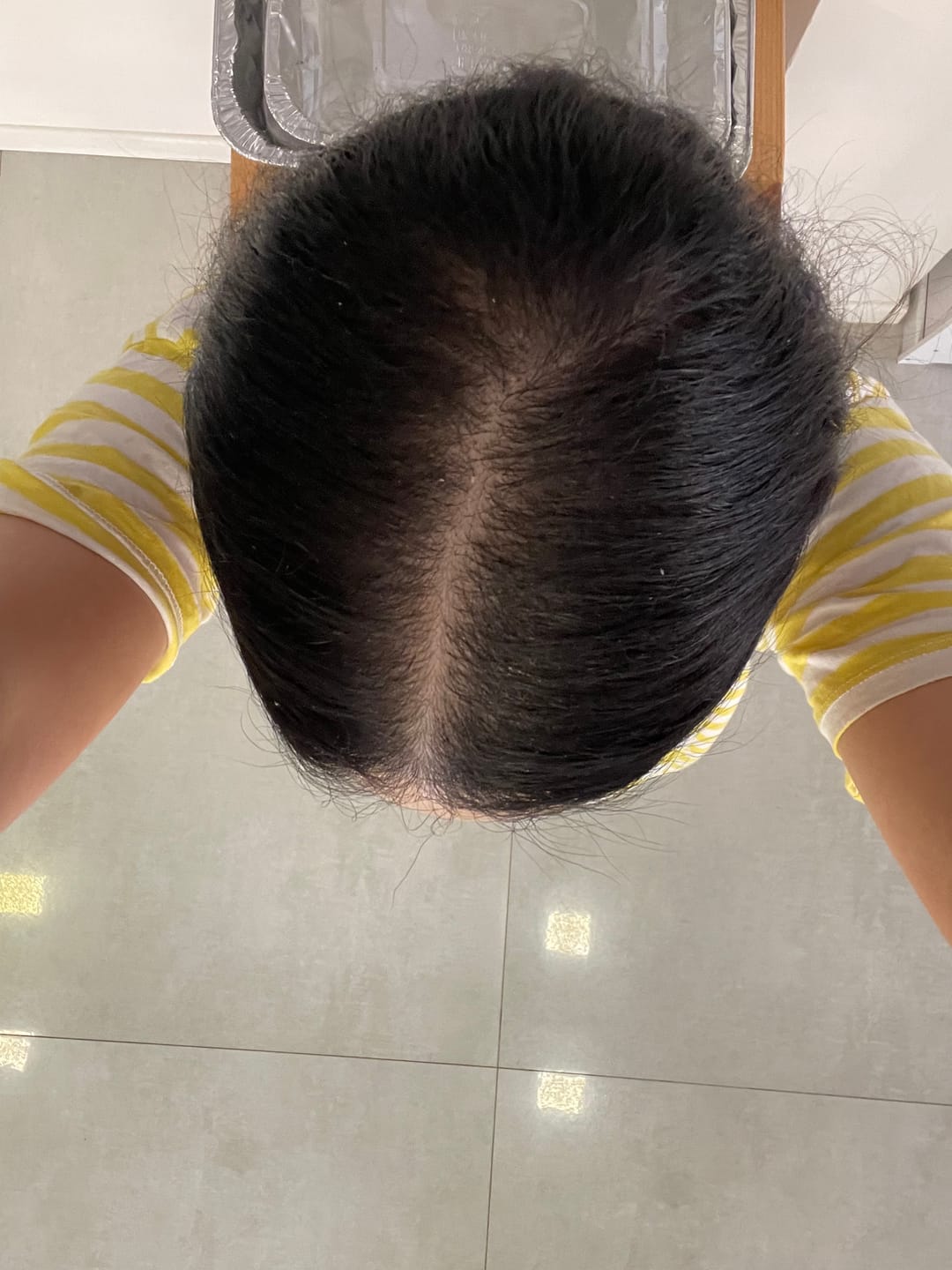 Customer photo review of VITAFOAM ™ Hair Growth Formula