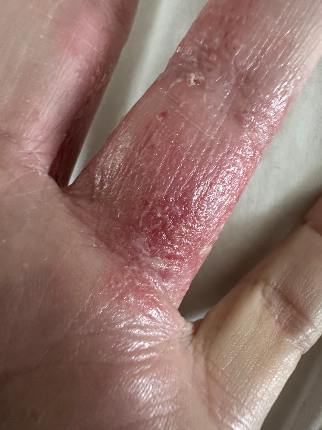 Customer photo review of Multi Strain Biotic