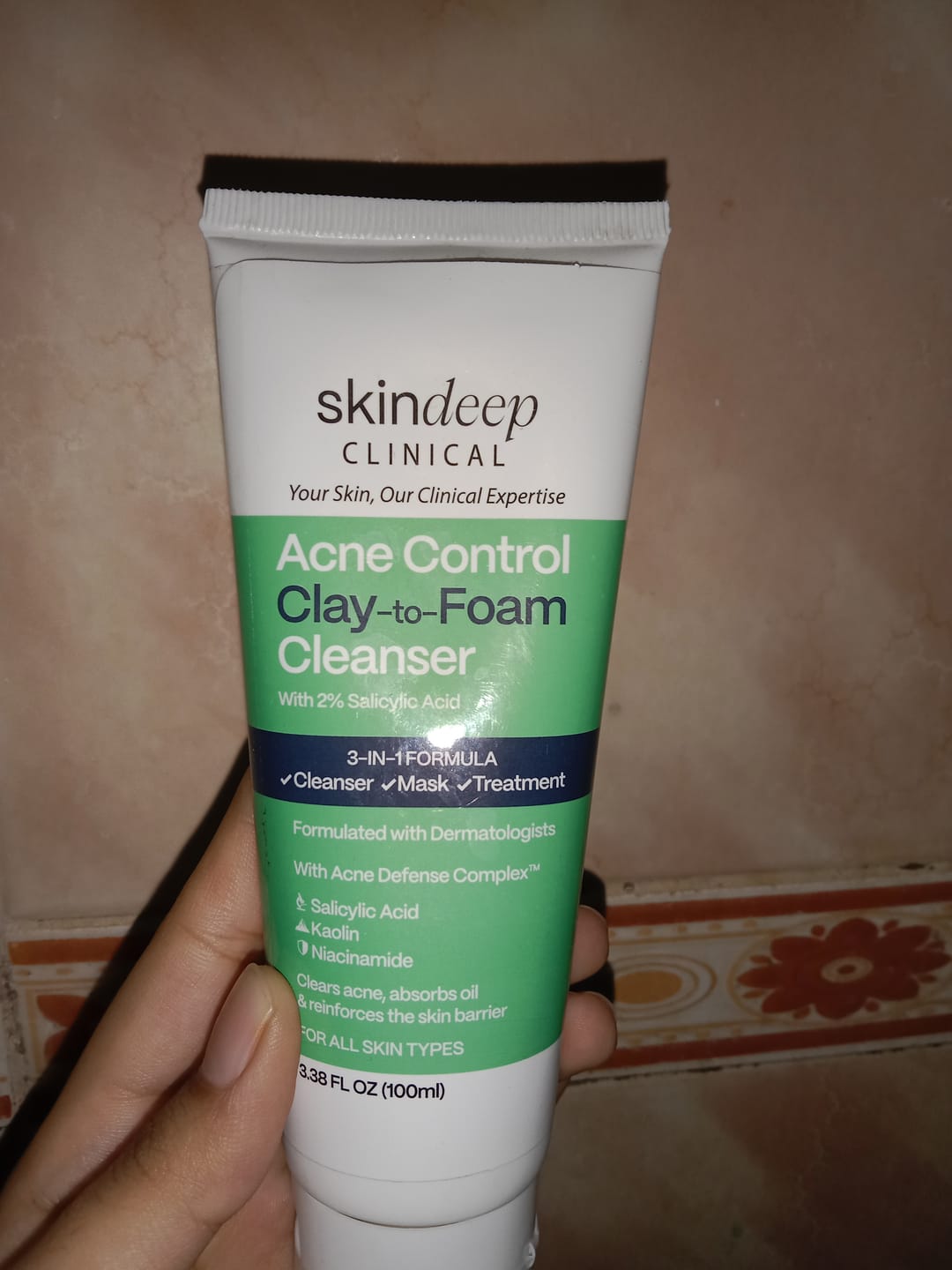 Customer photo review of Acne Control Clay-to-Foam Cleanser