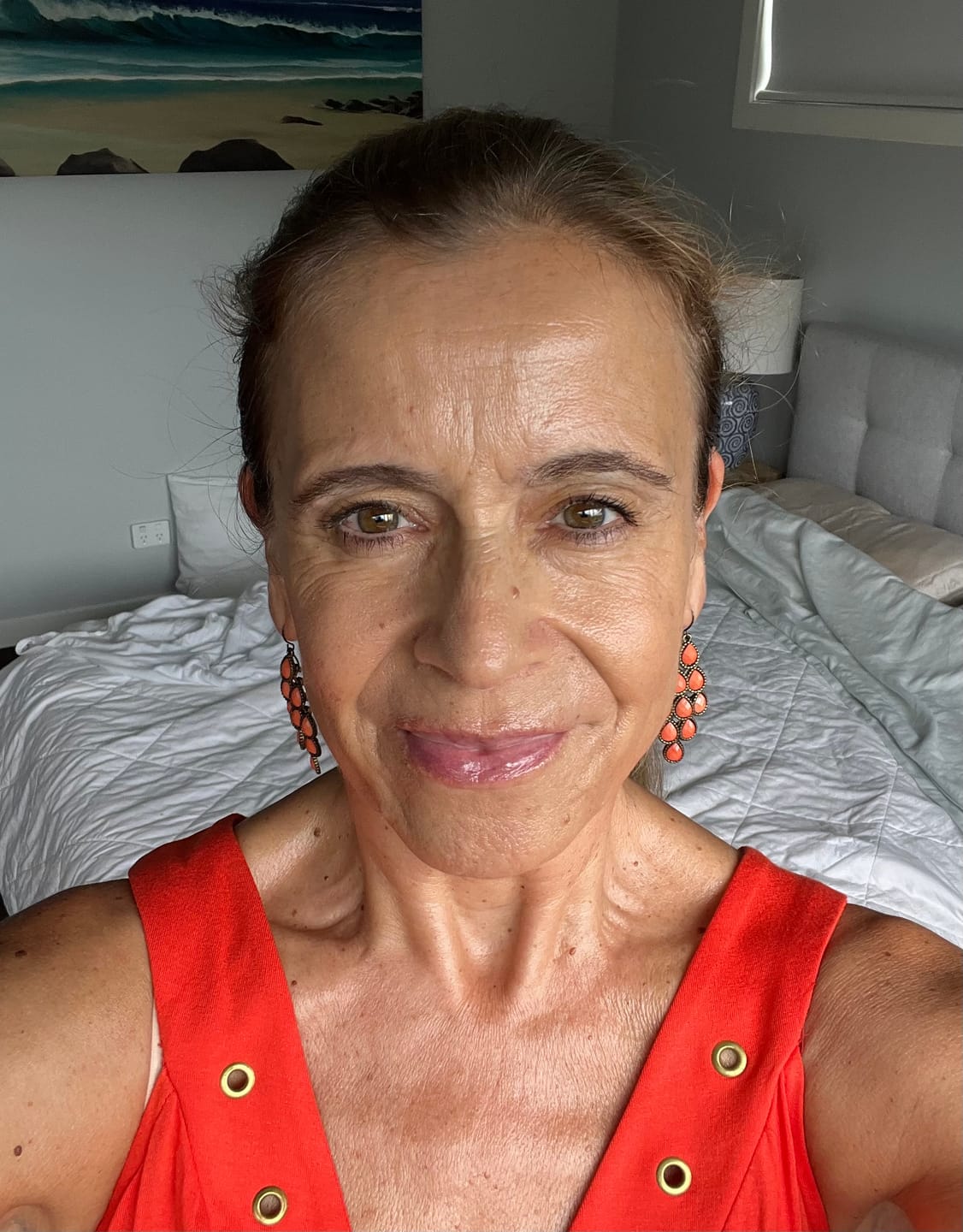 Customer photo review of SEA BUCKTHORN SERUM - 30ml