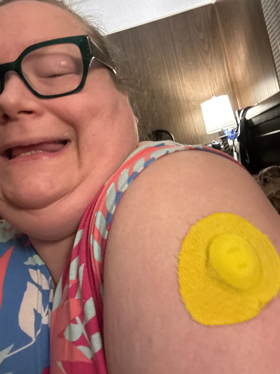 Customer photo review of Skin Grip Original - Dexcom G7 & Stelo Adhesive Patches