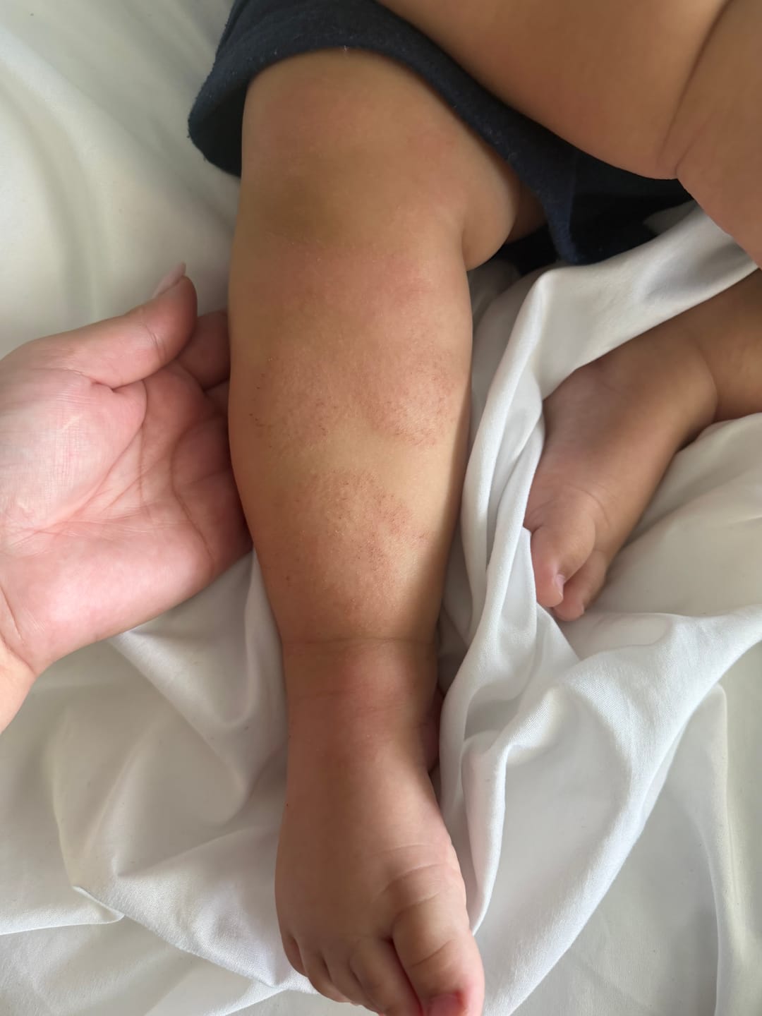 Customer photo review of Healing Salve