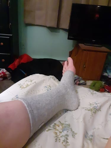 Customer photo review of StepCare Bamboo Foot Sleeve