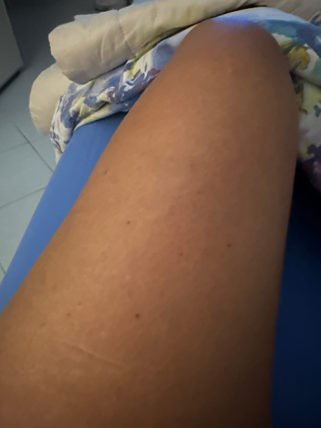 Customer photo review of Crema lifting corpo