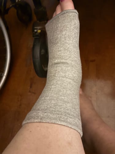 Customer photo review of StepCare Bamboo Foot Sleeve