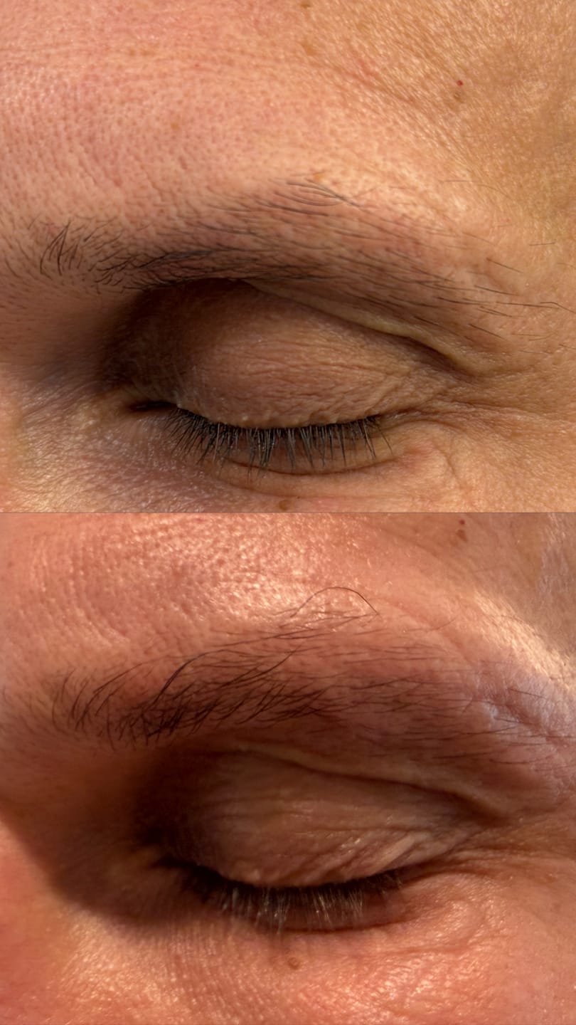 Customer photo review of Brow Rehab Serum