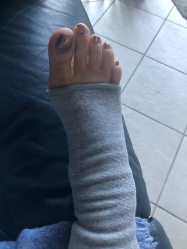 Customer photo review of StepCare Bamboo Foot Sleeve