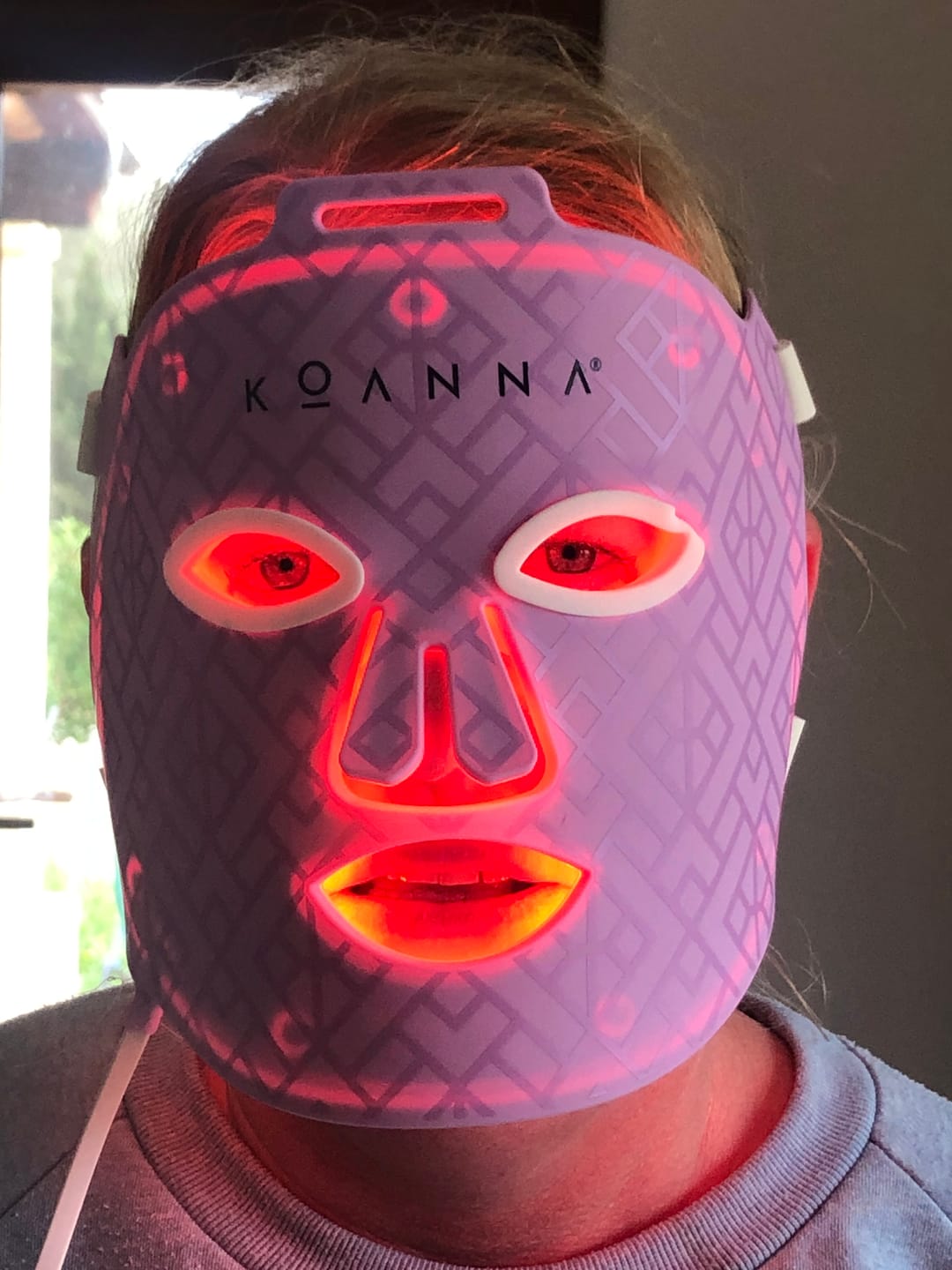Customer photo review of Koanna® MultiGlo™ LED Light Therapy Mask