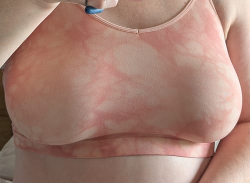 Customer photo review of Silicone Nipple Covers (Non-Adhesive)– Seamless, Reusable & Waterproof