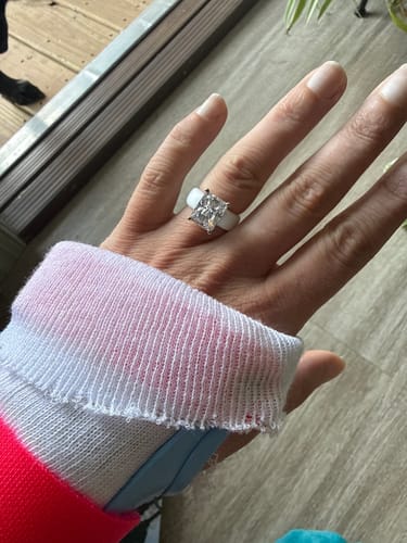Customer wearing the emerald-cut Silicone Ring with a cast on their wrist, showing how it fits a swollen finger.