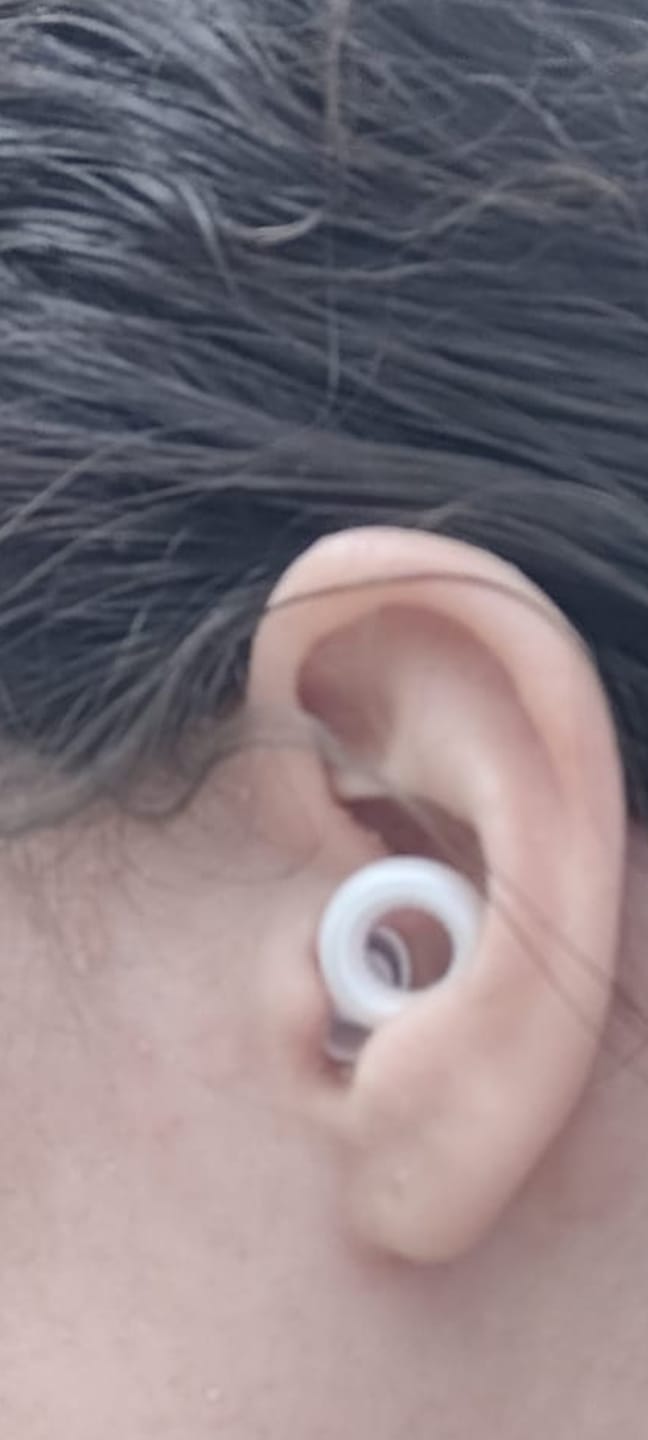 Customer photo review of מסנני סאונד אודיופיל זן | AudioFeel ZEN