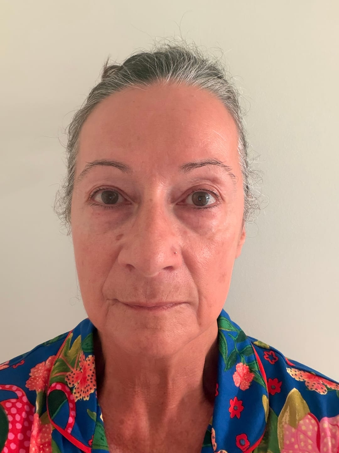 Customer photo review of The Complete System for Mature Women’s Skin