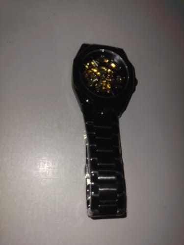 Customer photo review of ORENTH SKELETON®