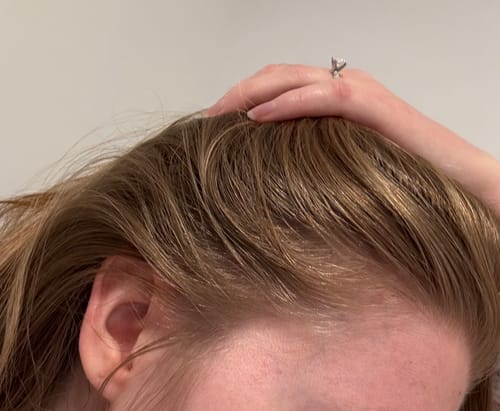 Customer photo review of Pre-Wash Scalp Oil by TR
