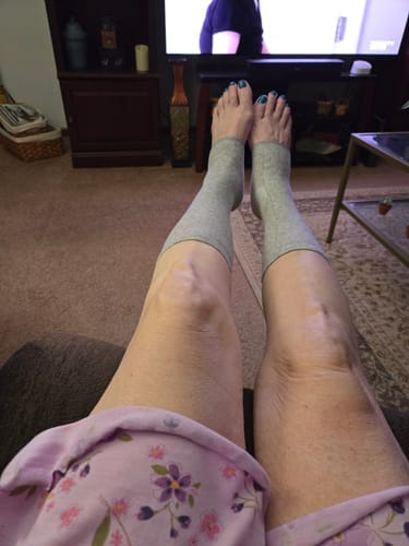 Customer photo review of StepCare Bamboo Foot Sleeve