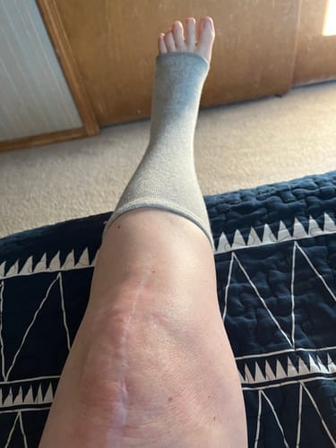 Customer photo review of StepCare Bamboo Foot Sleeve