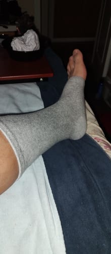 Customer photo review of StepCare Bamboo Foot Sleeve