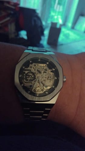 Customer photo review of ORENTH SKELETON®