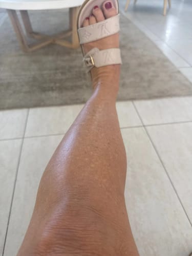 Customer photo review of Lumi Legs