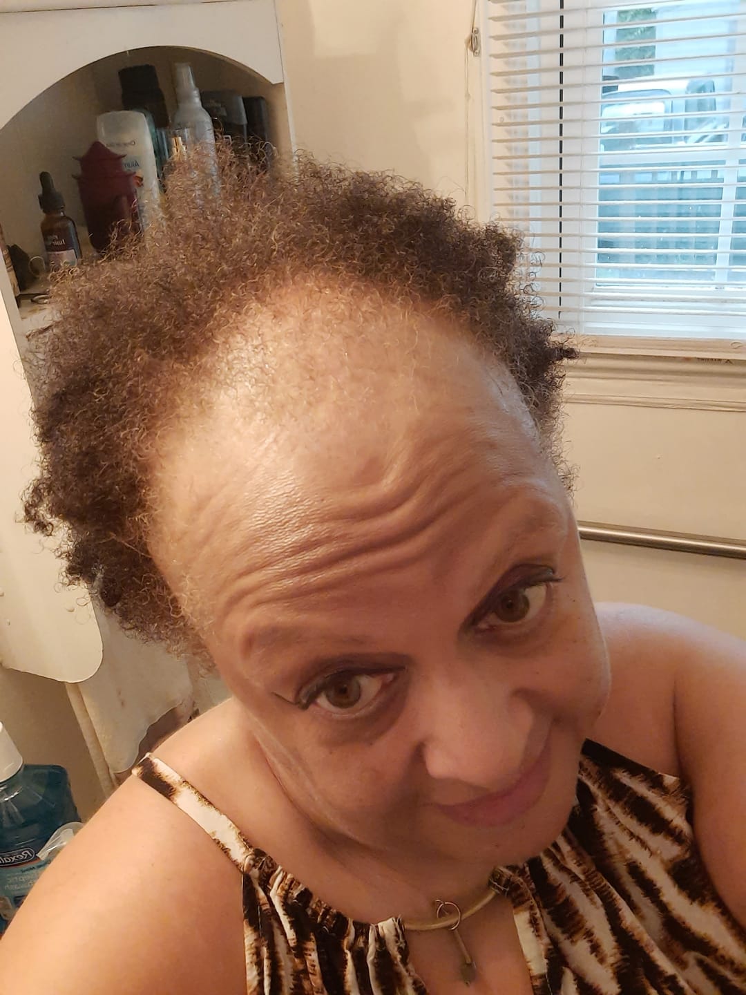 Customer photo review of BALM- Stimulating Scalp and Hair Balm