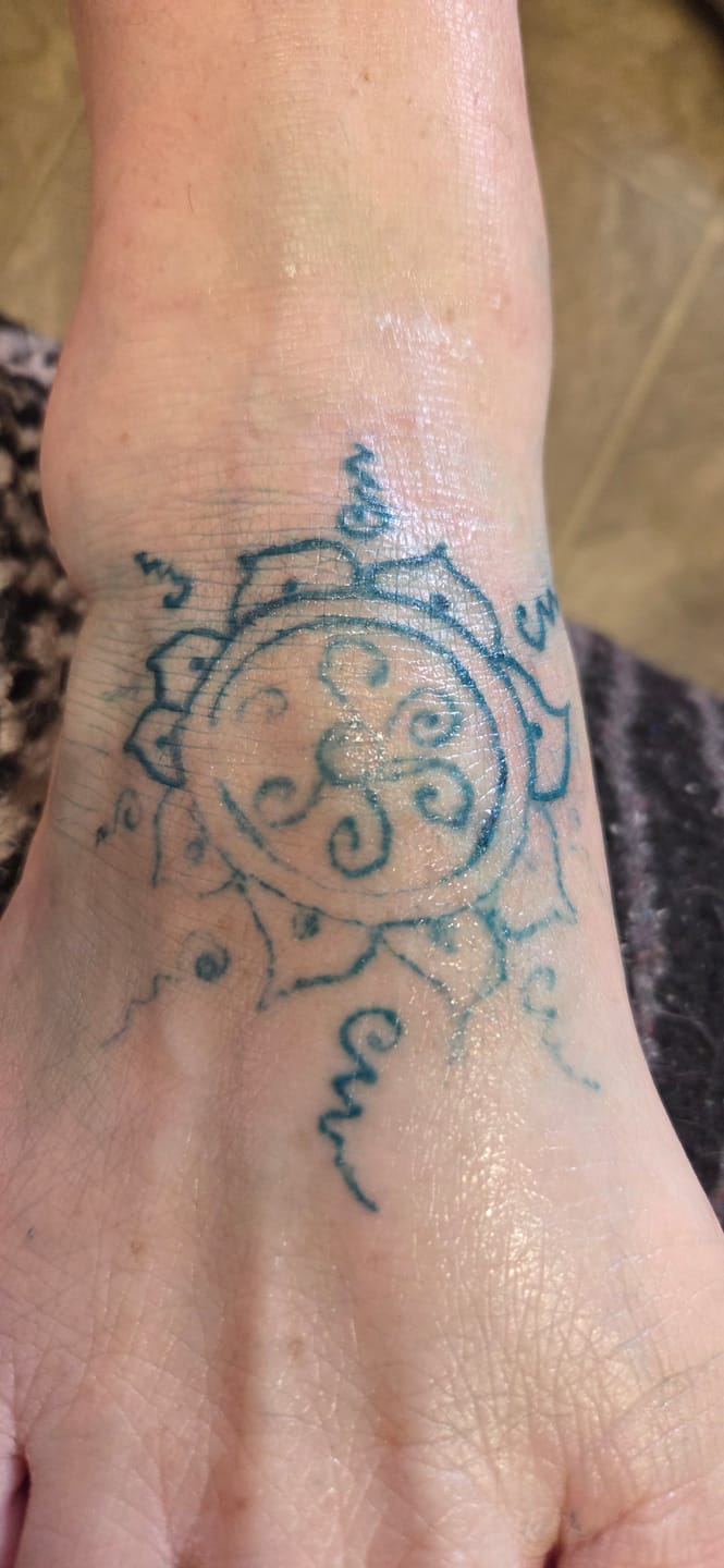 Customer photo review of Signature Numbing Cream: Buy 3, Get 2 FR 5 Tubes (Buy 3 Get 2 FREE)