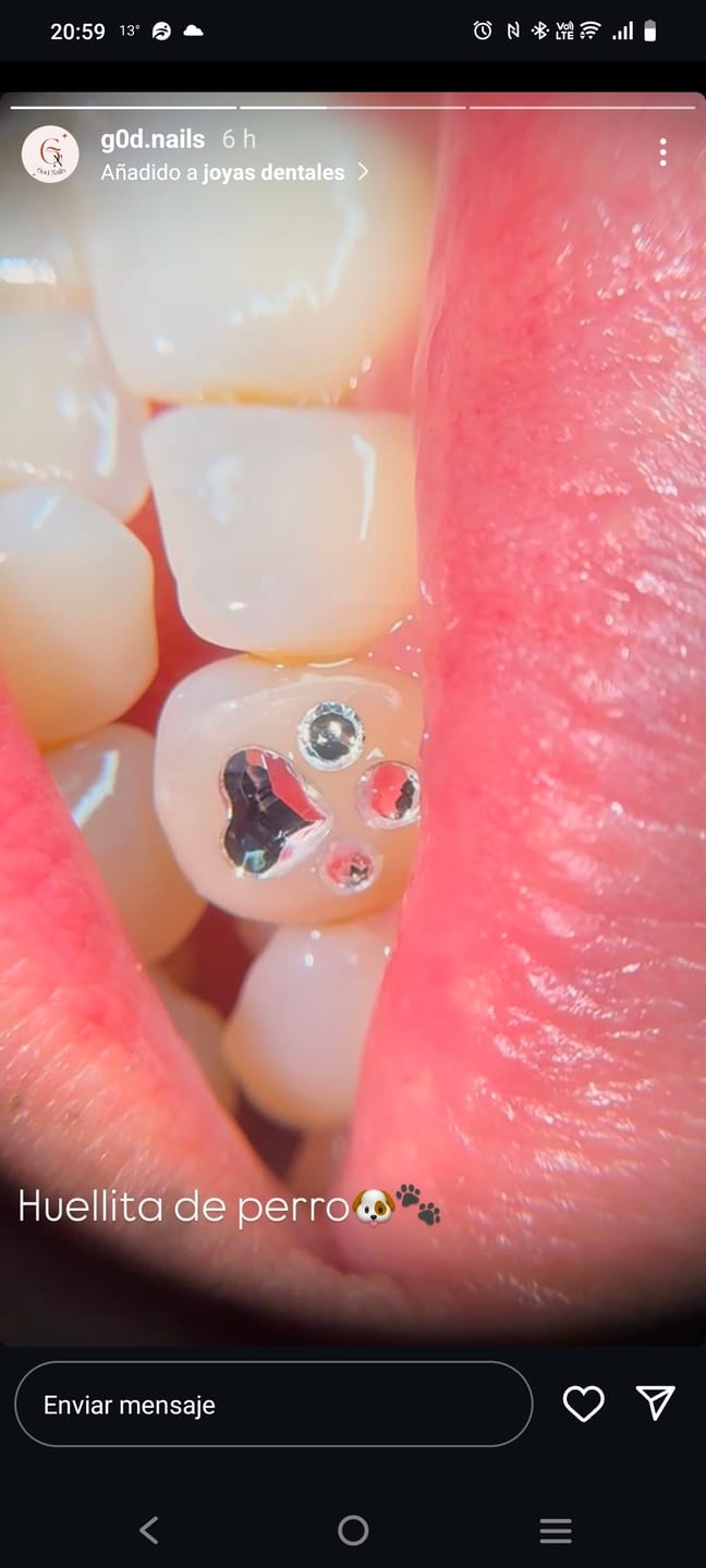 Customer photo review of Gemas dentales PRECIOSA® redondos - Crystal - SS2/SS7