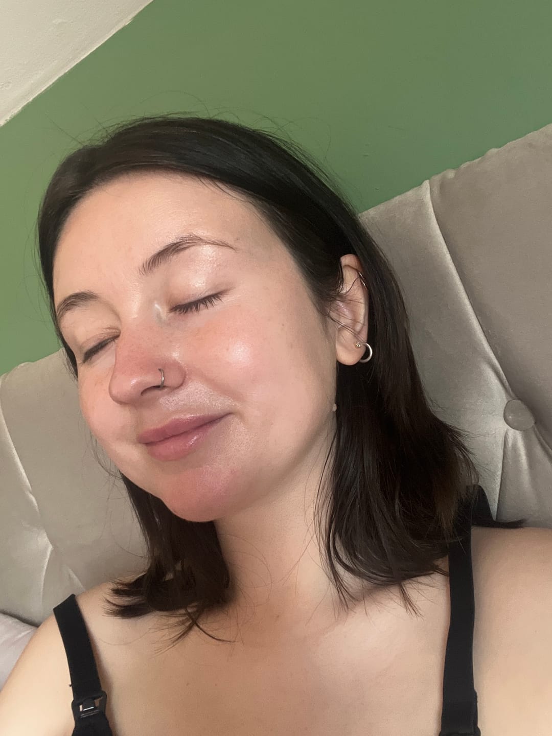 Customer photo review of Calm Balm