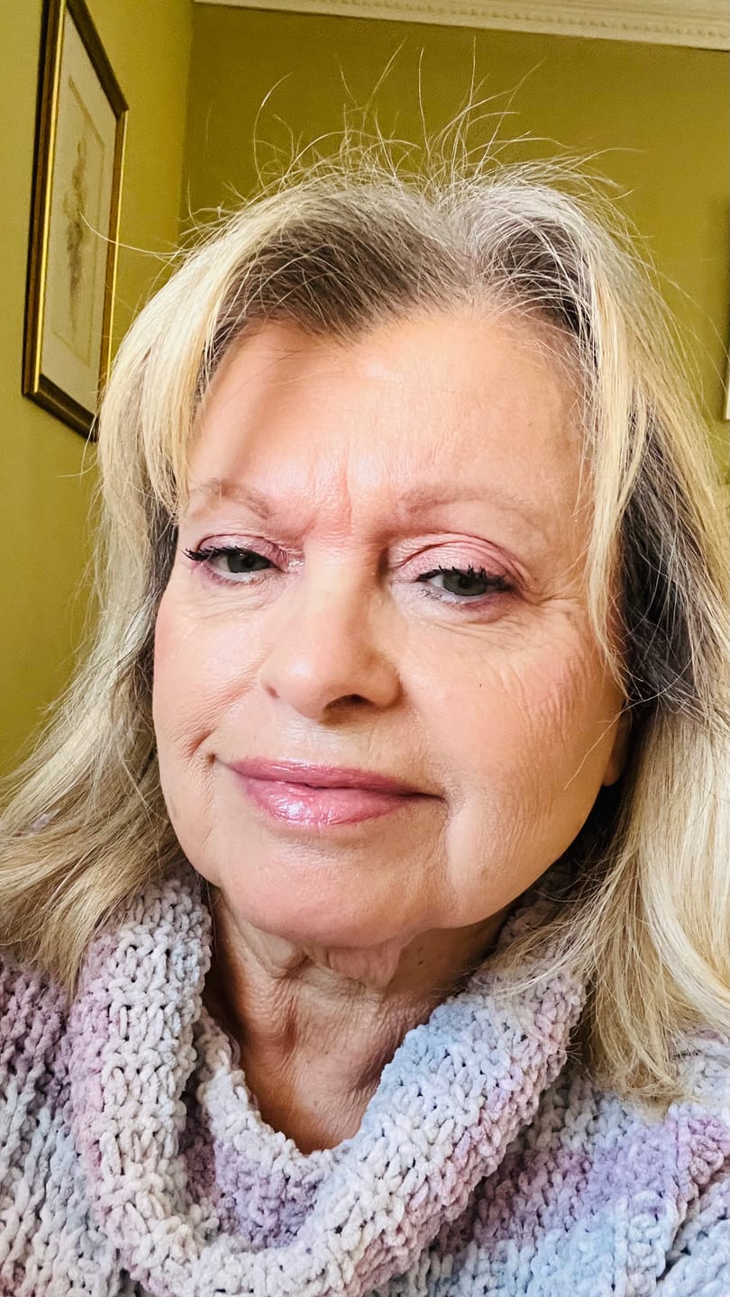 Customer photo review of Koriderm™ Time Reverse Cream (All-In-One)