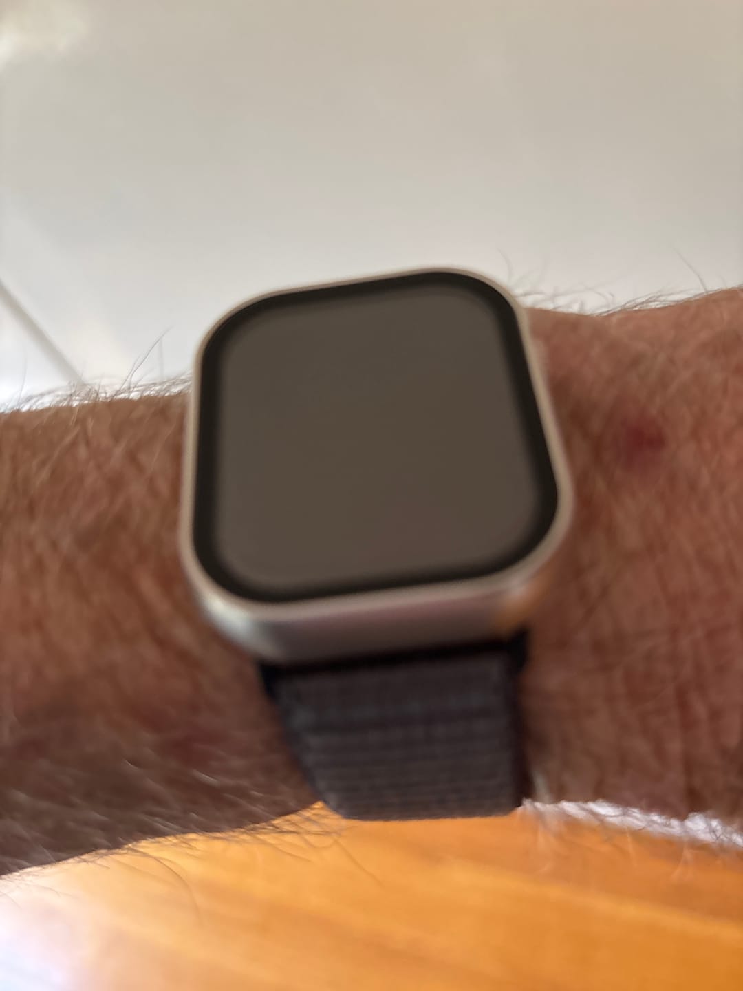 Customer photo review of All-in-one classic Apple Watch Protection Case