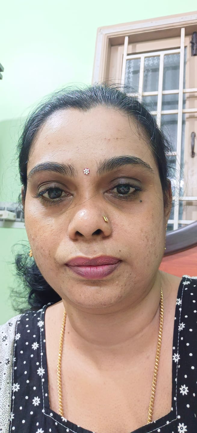 Customer photo review of Carrot Therapy Multi Correct Cream
