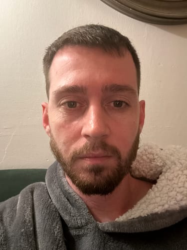 Customer photo review of Seb Natural Calming Serum