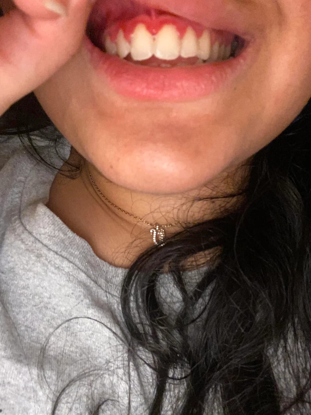 Customer photo review of Encivital® Polvo de Colágeno para Encías