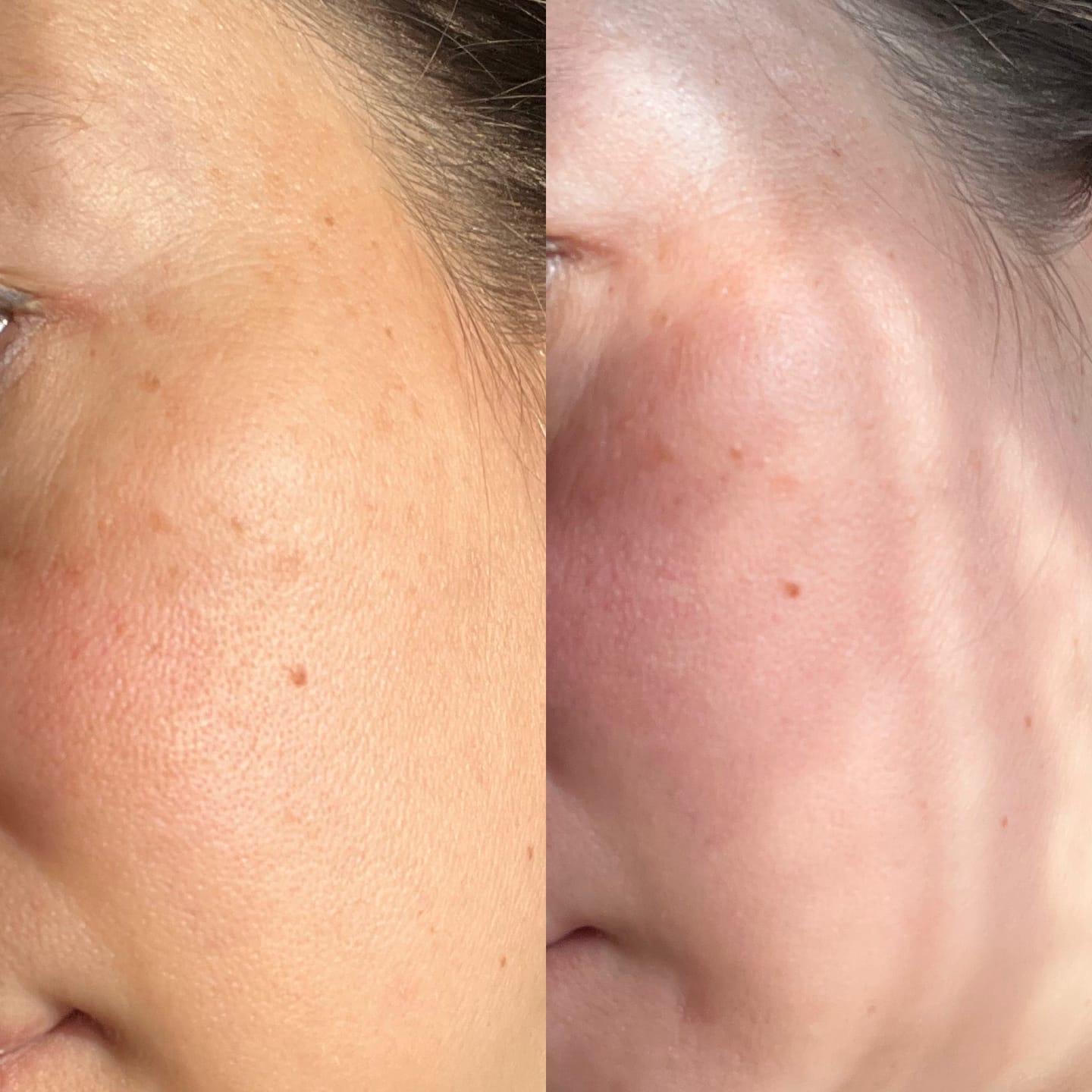 Customer photo review of Vitamina C  - Sérum Antioxidante