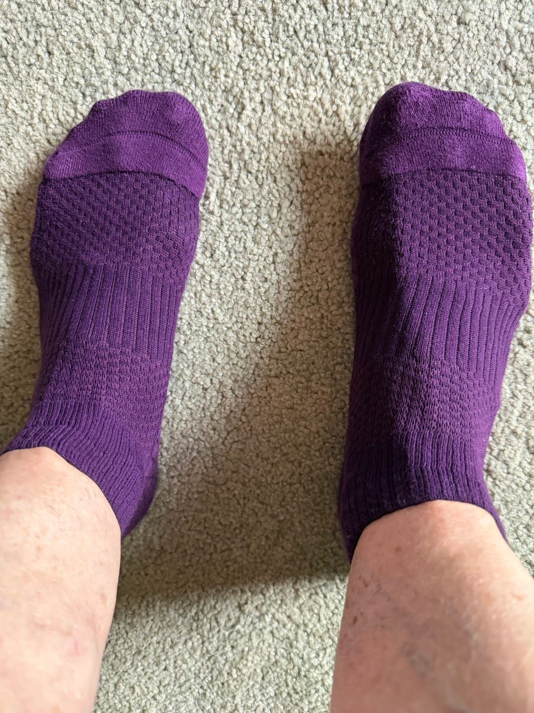 Customer photo review of Cosmic Fusion Ankle Compression Socks Bundle 5-Pack