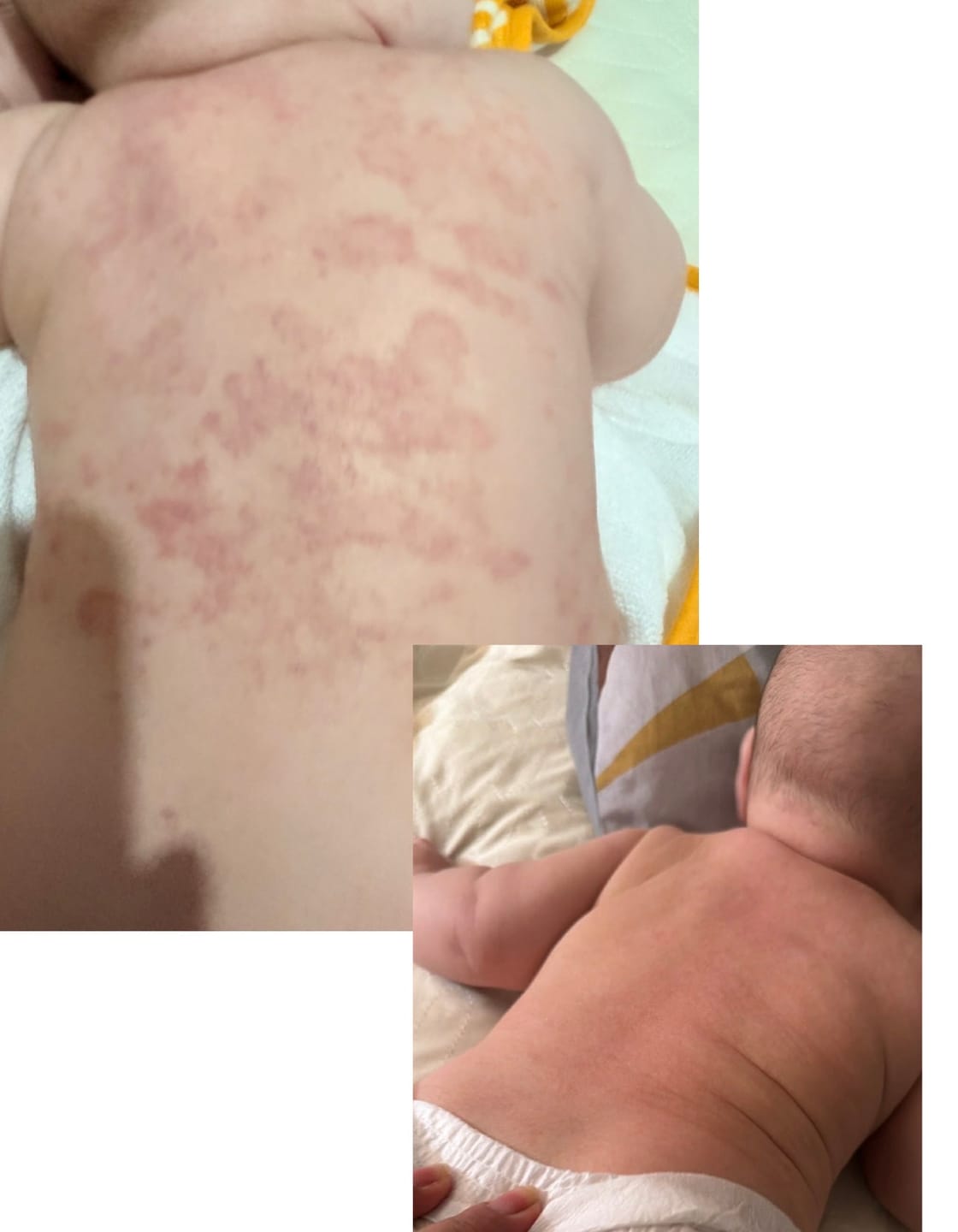 Customer photo review of Bioskin Junior Value Bundle