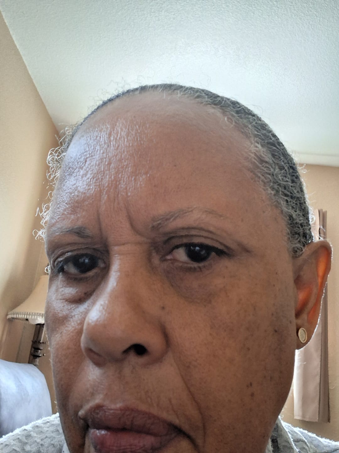 Customer photo review of Rennora Hair Growth Serum