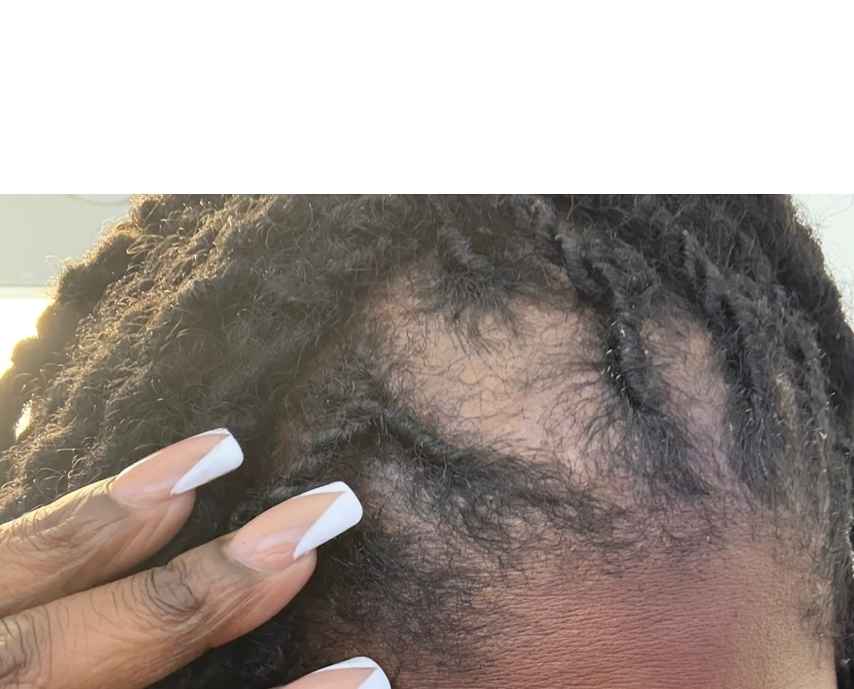 Customer photo review of Moisturize & Seal Bundle