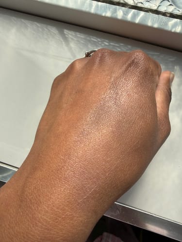 Customer photo review of Super Sensitive Mineral Sunscreen SPF 50 (Essential Oil Free)