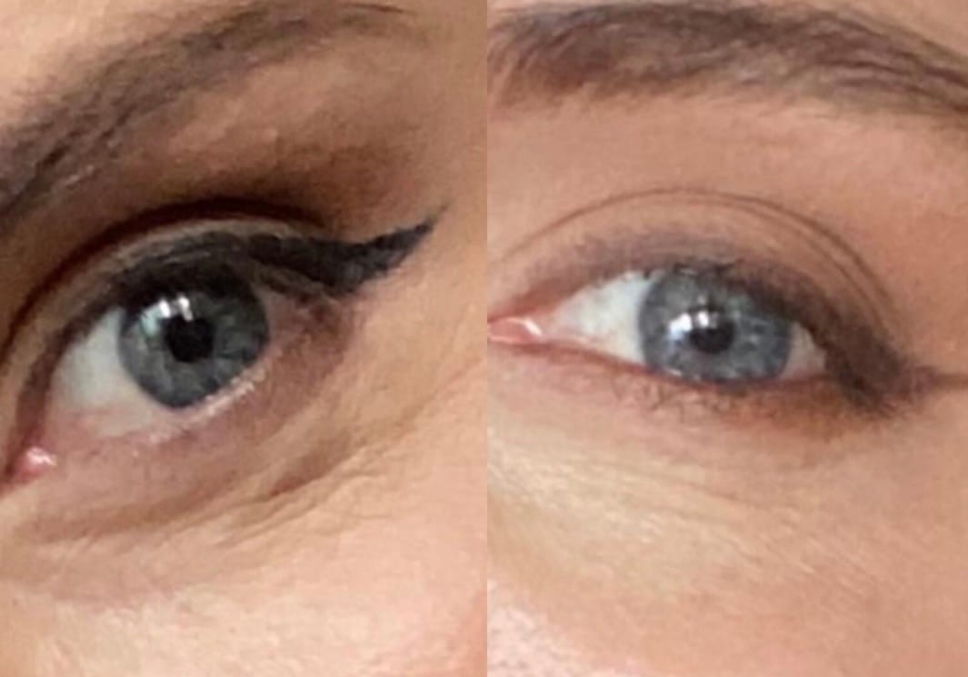 Customer photo review of Under Eye Skincare Wand