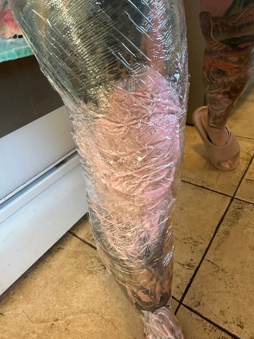 Customer photo review of Signature + Numbing Cream: Buy 3, Get 2  5 Tubes (3 + 2 FREE)