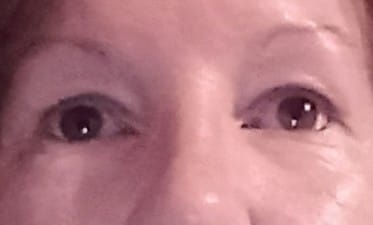 Customer photo review of Enhance® - Eyelash Growth Serum