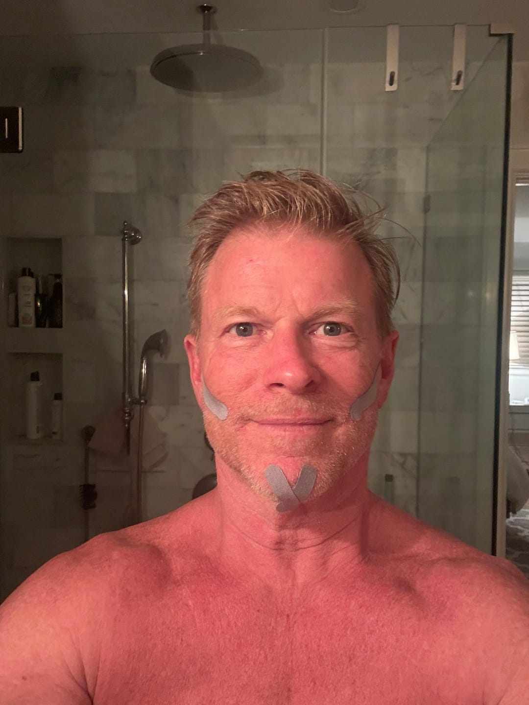 Customer photo review of Zygo Tape - Facial Sculpting & Anti-Aging Tape
