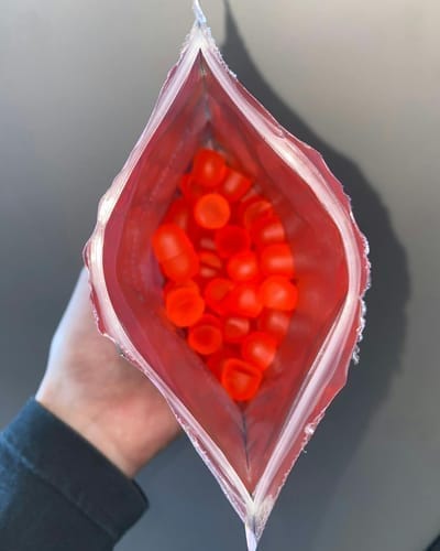 Customer photo review of LUMORYA® - Premium Balance Gummies