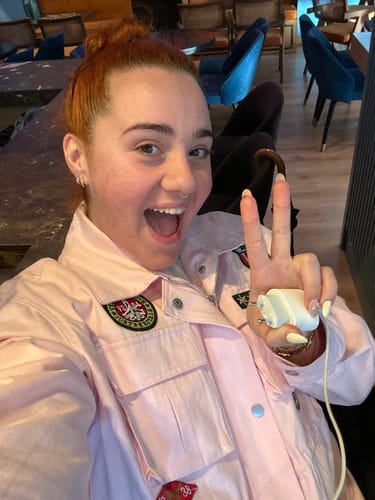 Customer photo review of Oversized jacket με patches