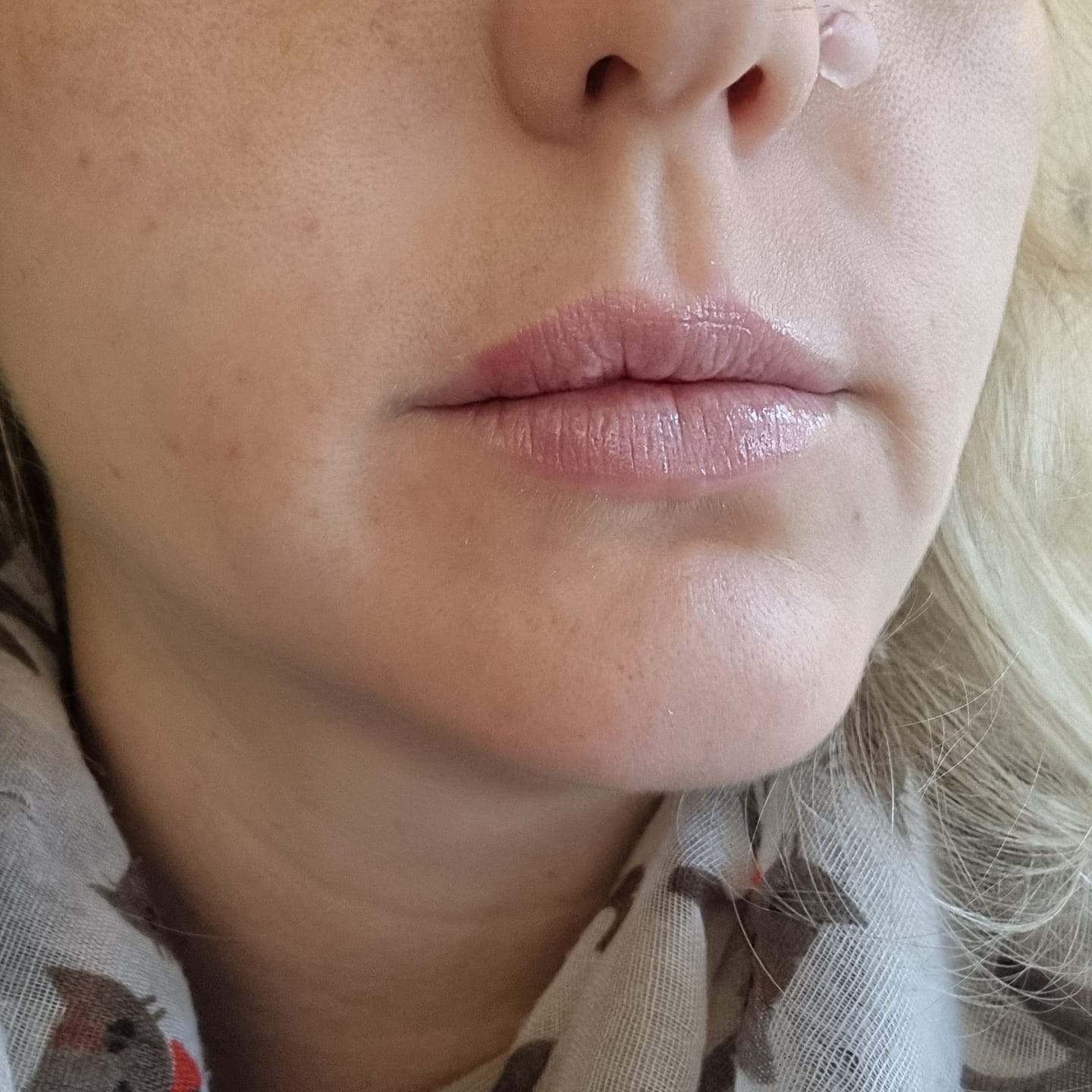 Customer photo review of SOENTJIES® FullPout Hydrating Balm