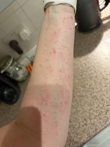 Customer photo review of Fera Tallow Colloidal Oat Whipped Tallow - Soothing Eczema & Sensitive Skin Cream