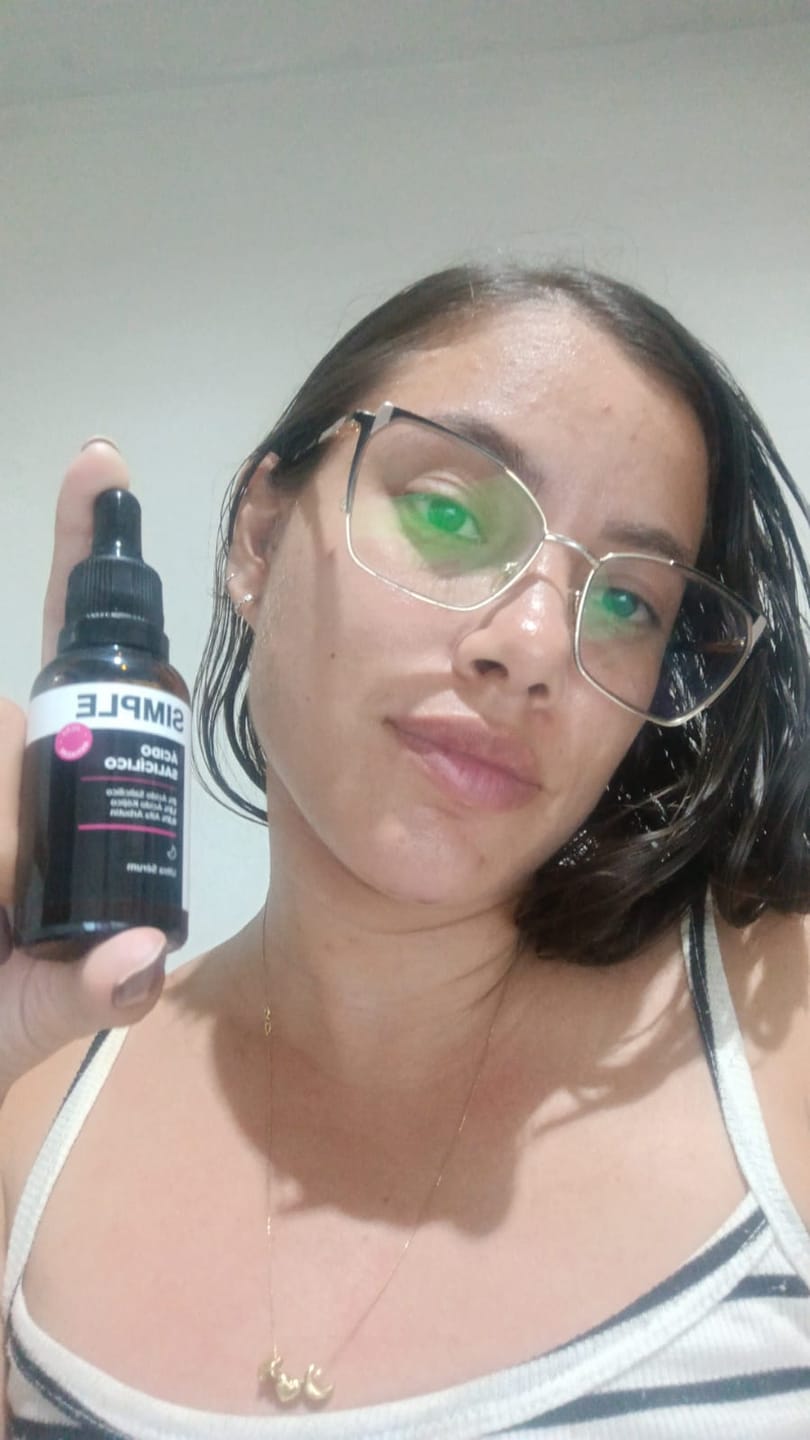 Customer photo review of Rotina Pele Acneica