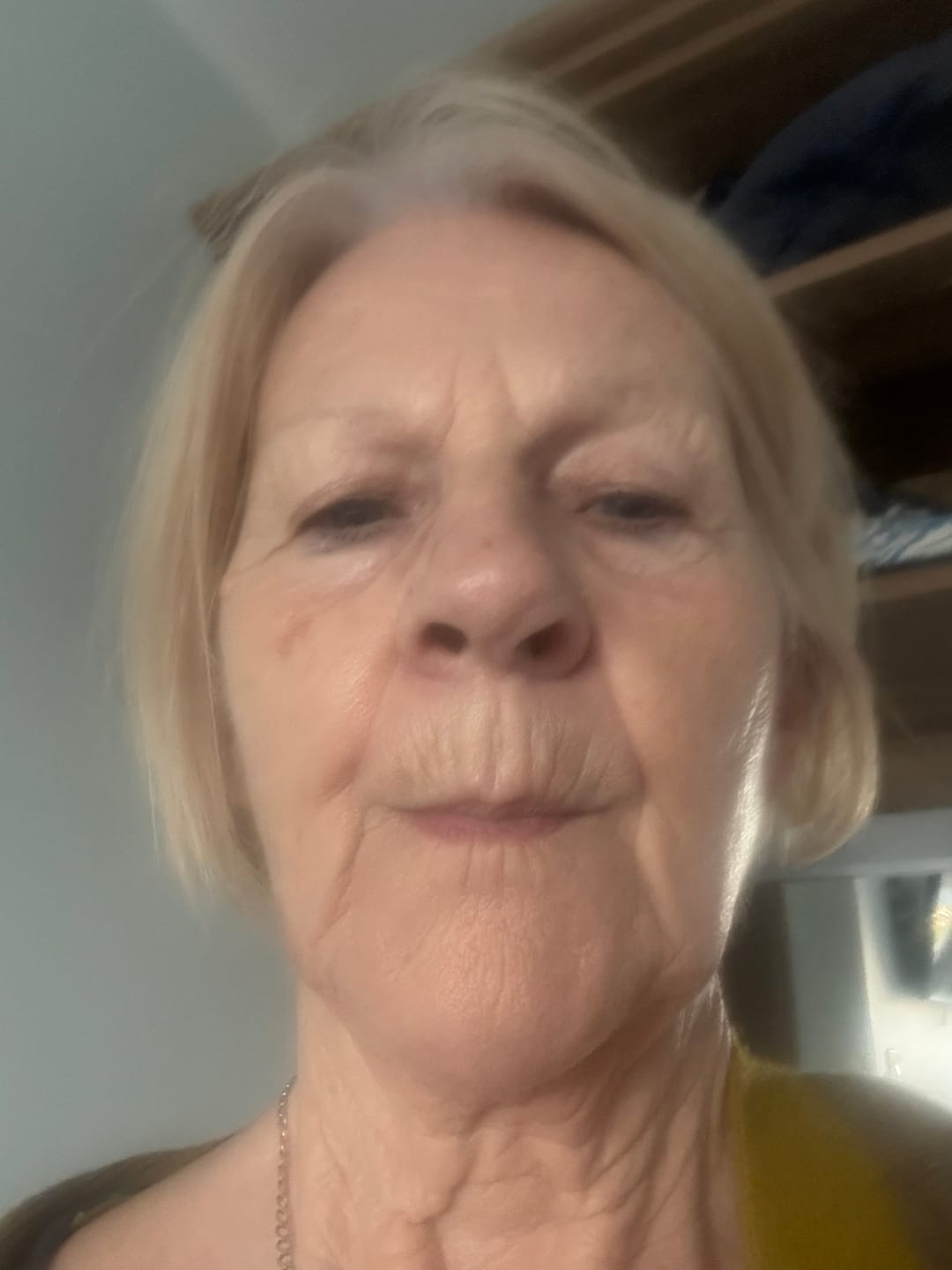 Customer photo review of 5-Step Clear Skin Kit