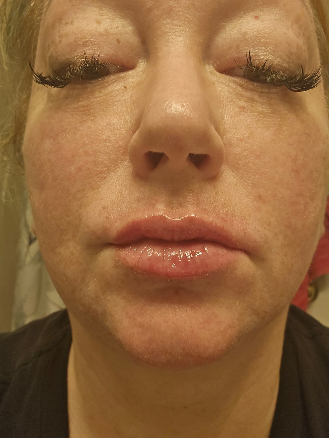 Customer photo review of Extreme Lip Plumper