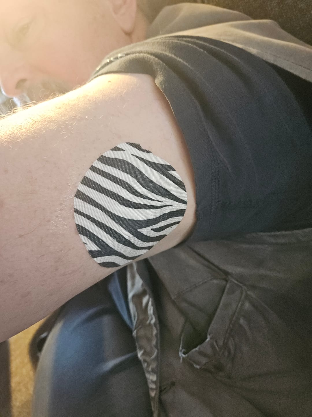 Customer photo review of Skin Grip Original - Dexcom G7 & Stelo Adhesive Patches